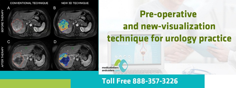 Pre-operative and New-Visualization Technique for Urology Practice